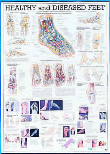 Healthy & Diseased Feet Chart