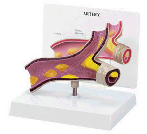 Artery Budget Model
