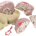 Brain and Partial Skull Budget Model