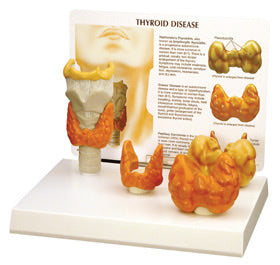 Thyroid Model Set of Four Budget Model