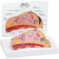 Breast Cross Section Budget Model Showing Pathologies