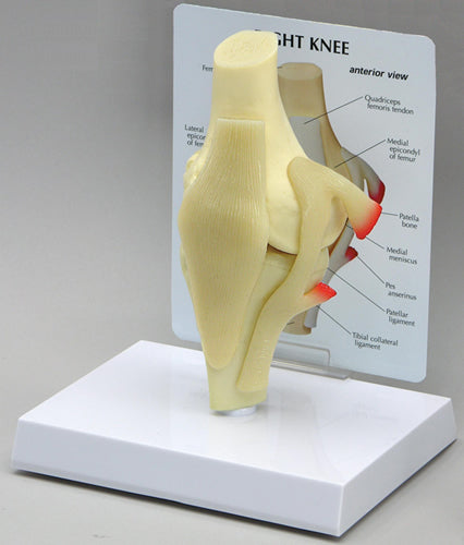 Basic Knee - Budget Model