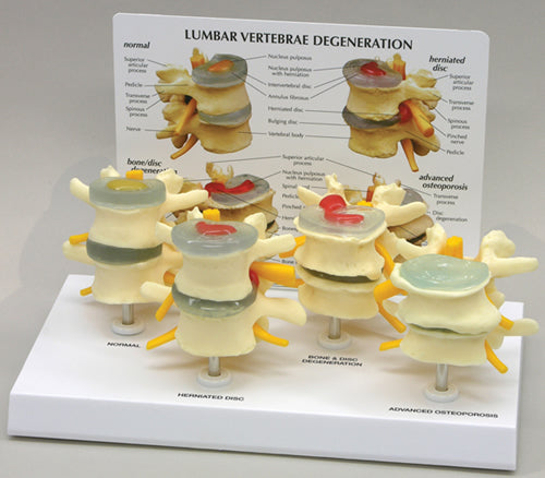 Four Stage Vertebrae - Budget Model
