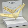 Basic Elbow - Budget Model
