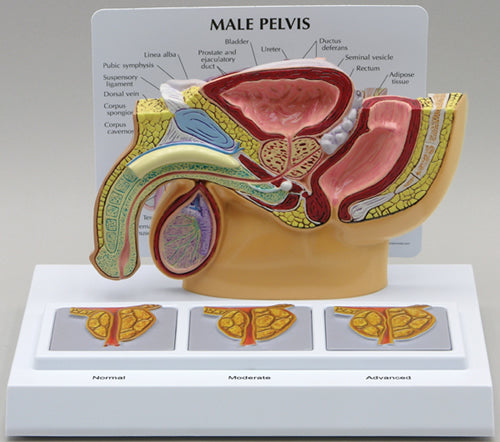 Male Pelvis Cross Section - Budget Model