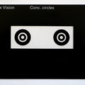 Slimline Overlay Concentric Circles