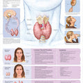 Thyroid Disorders Chart