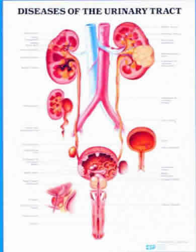 Diseases Of Urinary Tract Chart