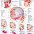 Headache Chart