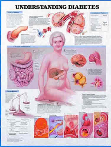 Understanding Diabetes