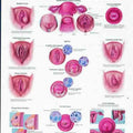 Female External Genitalia - Anatomy & Pathology