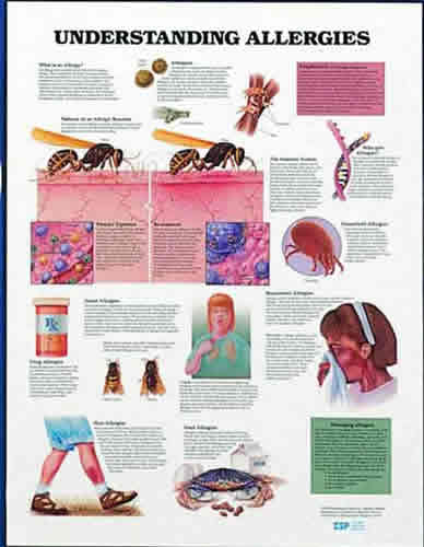 Understand Allergies Chart