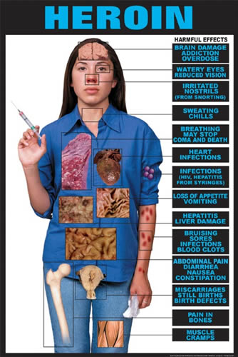 Harmful Effects Heroin Chart