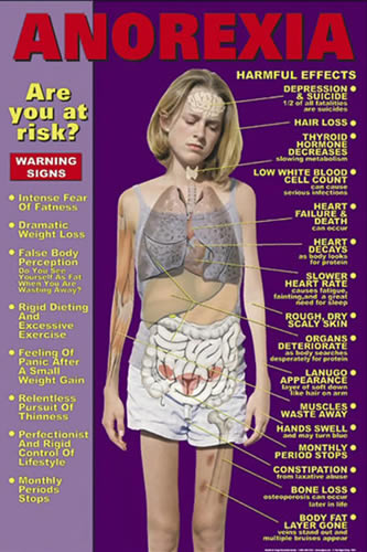 Anorexia Chart