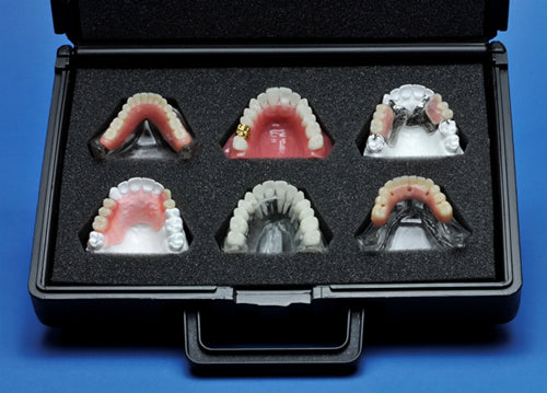 Implant Practice Building Kit