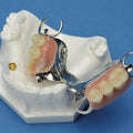 Partial Framework Maxilla with Locator Stud & Cap