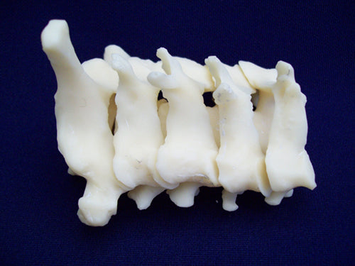 Cervical - Vertebra