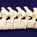 Thoracic - Vertebra
