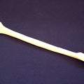 Radius