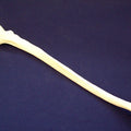 Ulna