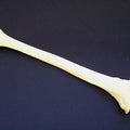 Tibia