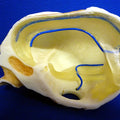 Foetal Half Skull
