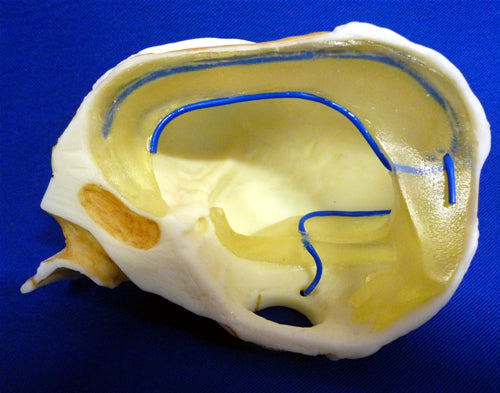 Foetal Half Skull