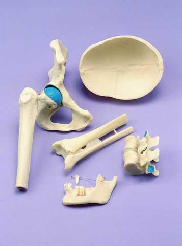 Joints Set Of 5