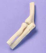 Elbow - Miniature Joint