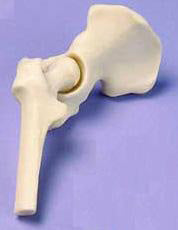 Hip - Miniature Joint