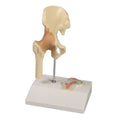 Hip Joint, 1/2 Life Size with Cross Section