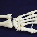 Wrist Joint Movable