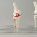 Knee Implant Model, Set of 3 Joints
