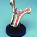Femur Head With Osteoporosis