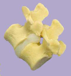Vertebral Joint,Slipped Disc