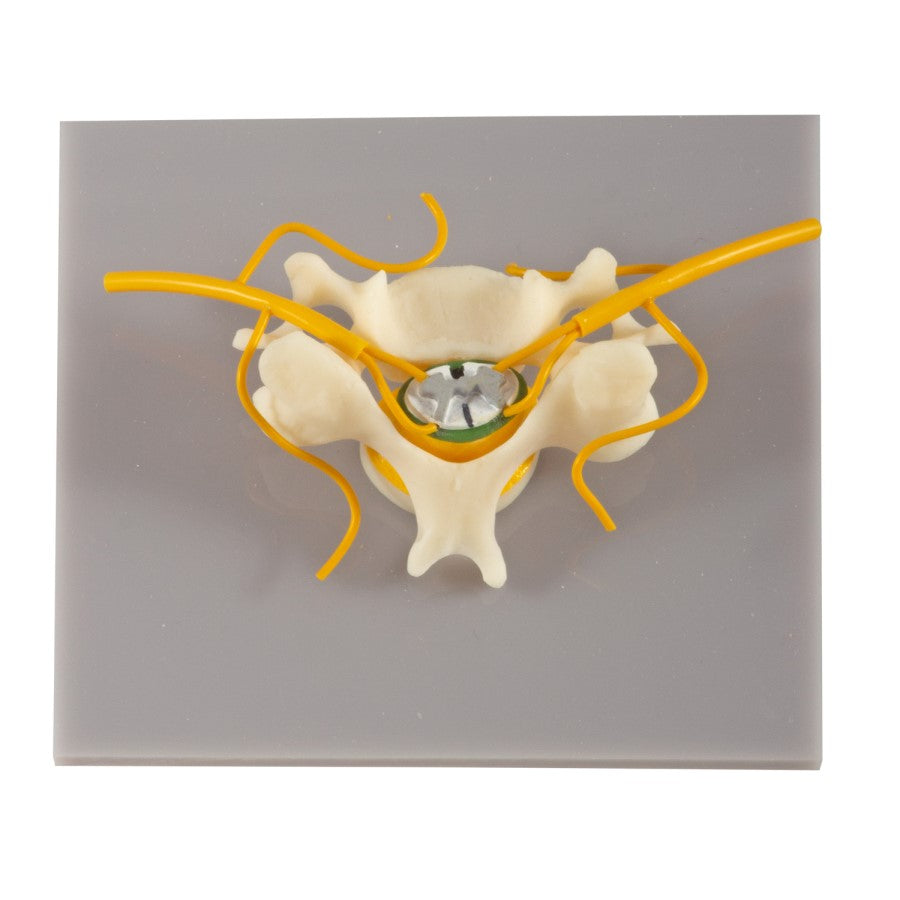 Vertebra With Spinal Cord