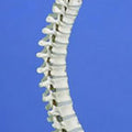 Rigid Spine, Medical