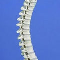 Flexible Spine, Medical