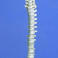 Rigid Spine, Medical, With Pelvis