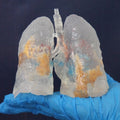 3D Printed COVID-19 Lungs Mini Size