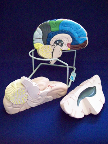 Brain,Enlarged