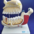 Upper and Lower Jaw Model