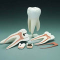 Tooth Decay Model