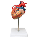 Heart X2 With Bypass, 4 Parts