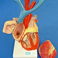 Heart Enlarged, Flexible Model