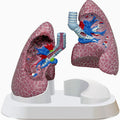 Lung Pathologies
