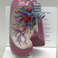Lung - Budget Model