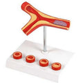 Atherosclerosis & Thrombosis Model