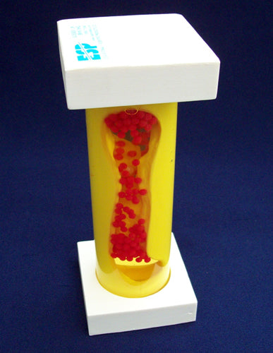 Occluded Artery Model