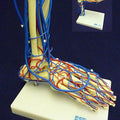Vascular Foot